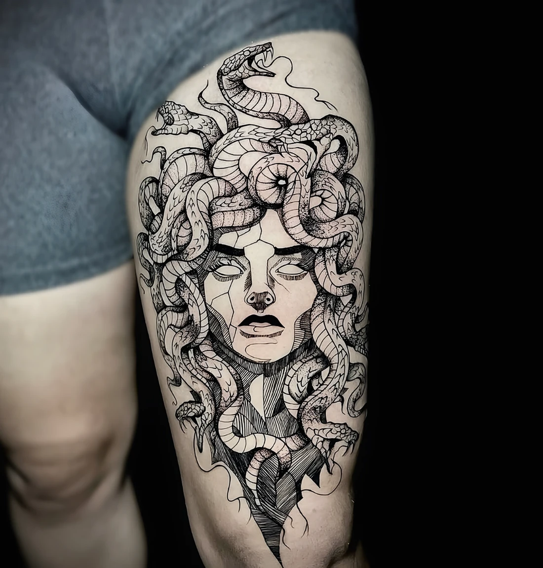 Medusa